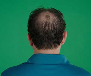 Hair Grow Max 2x1 a 248 LEU