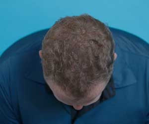 Hair Grow Max 2x1 a 214 PLN