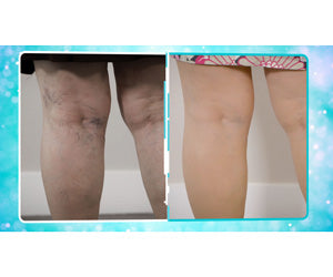 Veins Gone 2x1 a 39,99€