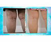 Veins Gone 2x1 a 15.583 HUF